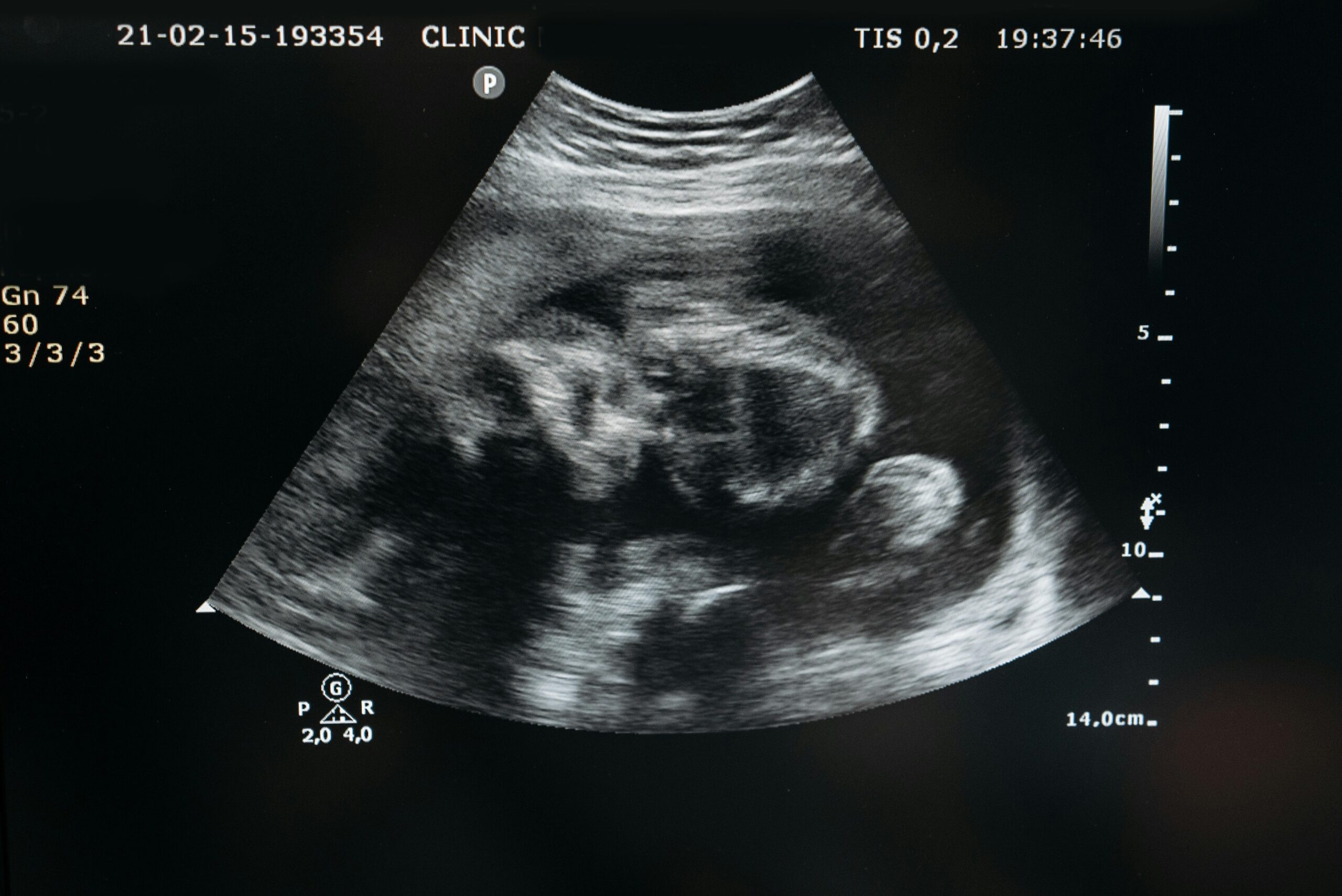Kostenloses Stock Foto zu babyscan, das baby ist auf dem weg, diagnostische bildgebung